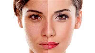 لتفتيح البشرة وتوحيدها| حضري ماسك العسل بالليمون