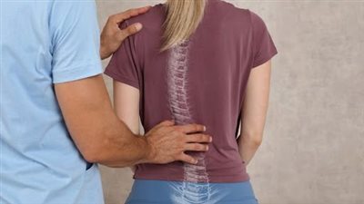 تعريف عملية اعوجاج العمود الفقري وأهميتها