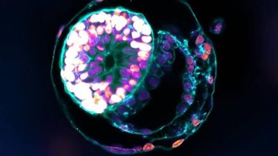 حقيقة إنتاج جنين بشري من دون بويضات ولا حيوان منوي (فيديو)