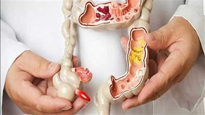 الأطعمة الغنية بالألياف تساعد على الوقاية من سرطان القولون 