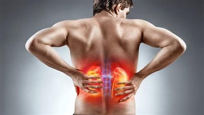 الناجون من سرطان الغدد الليمفاوية أكثر عرضة للإصابة بأمراض الكلى 