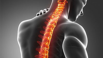 الورم الشوكي.. مرض يصيب العمود الفقري والنخاع| أعراضه وأبرز انواعه