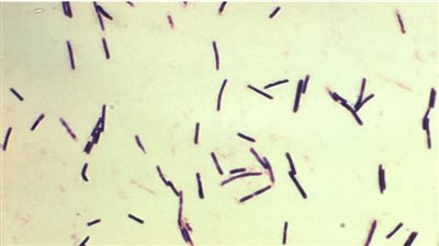 مرض غامض في بلد إفريقي يقتل 7 أشخاص ويصيب العشرات