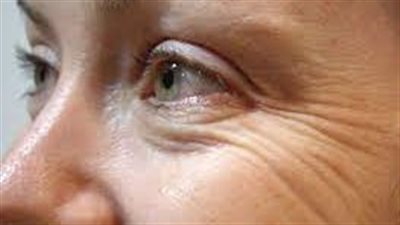 تجاعيد الوجه تظهر بعد النوم.. أعرف السبب 