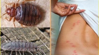 بق الفراش يغزو فرنسا قبل دورة الألعاب الأولمبية