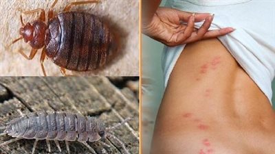 غزت المدن.. ماهي حشرة بق الفراش؟ وما أسباب ظهورها؟