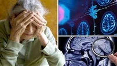 النعناع.. علاج جديد للزهايمر