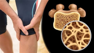 تناول الخوخ مفيد لصحة عظام المرأة