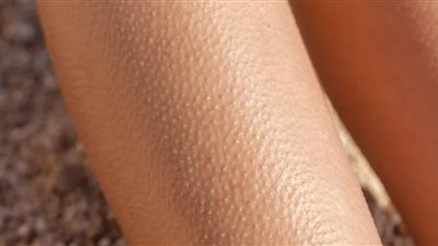 تخلصي من جلد الوزة إلى الأبد..5 نصائح سحرية تعرفي عليها