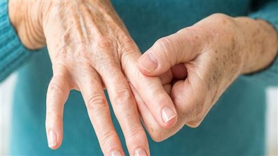 أعراض غير عادية لالتهاب المفاصل الروماتويدي.. مشاكل في السمع أبرزها 