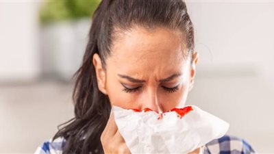 أسباب نزيف الأنف المفاجيء وعلاقته بارتفاع ضغط الدم