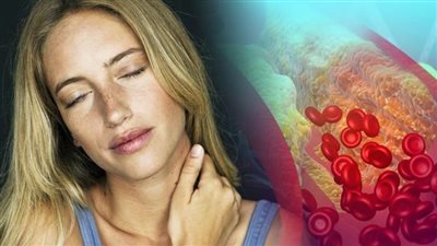 ما الذي يؤدي إلى زيادة نسبة الكولسترول في الجسم؟