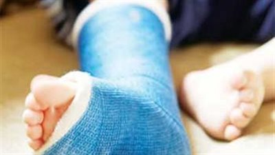 مدى اشتراط الطهارة عند وضع الجبيرة