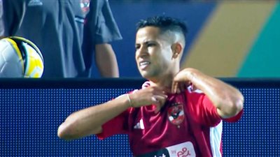 إصابة رضا سليم بكسر في 