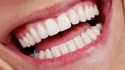 7 أطعمة تضر بمينا الأسنان.. أبرزها الحمضيات