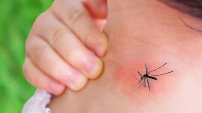 حمى الضنك في مصر.. مستشار الرئيس يطمئن المواطنين