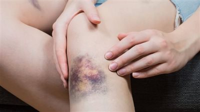 مشاهدة التلفاز لفترة طويلة تهدد بجلطات دموية خطيرة.. دراسة توضح 