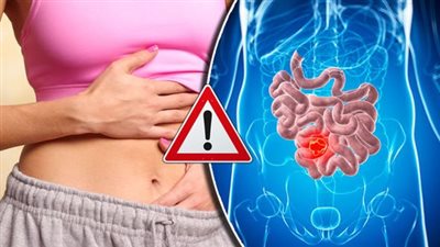 نوع من الفواكة الاستوائية قادرة على حمايتك من الإمساك 