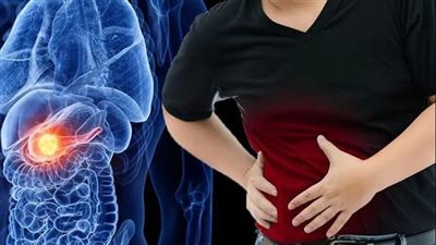 منها السرطان.. مشاكل صحية مرتبطة بالبنكرياس