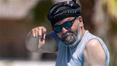 تسمم في الدم وحالة حرجة.. أحمد البدري يواجه مضاعفات صادمة بعد بتر قدمه