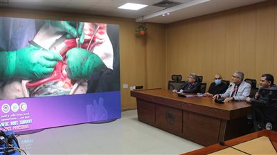 بدء فعاليات ورشة عمل 