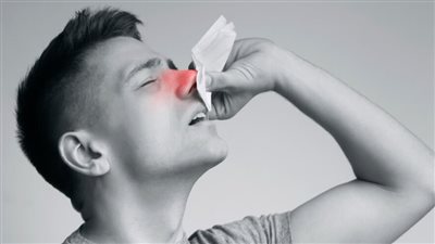 أسباب نزيف الأنف 