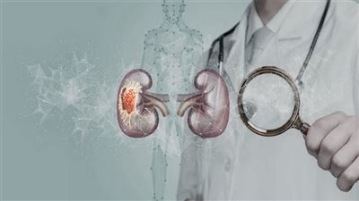 علامات خطر تشير للإصابة بسرطان الكلى.. عوامل تطوير المرض