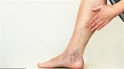 الوقوف على قدميك لفترة طويلة يهدد بمشاكل وأمراض خطيرة