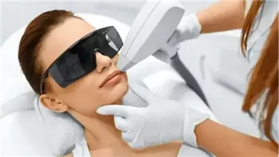 تأثير إزالة الشعر بالليزر على مرضى السكري