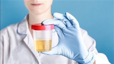 تحليل البول يساعد في البحث عن أورام الأطفال والبالغين