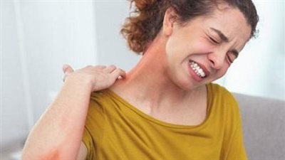 التزرق الشبكي .. علامة تظهر على الجلد تشير للإصابة بمرض قاتل (أطباء يحذرون)