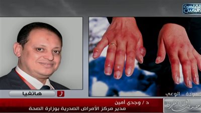مدير الأمراض الصدرية بوزارة الصحة يحذر من 