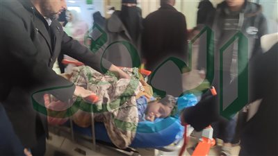 إجراء ٢٥١ عملية لإزالة اللوز لاطفال قوائم الانتظار 