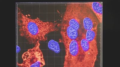 الاستعداد للمرض X.. كيف يستعد العلماء للوباء المقبل