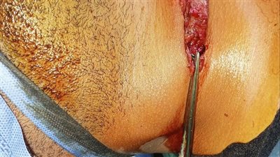 مستشفي جامعة سوهاج تنجح في إنقاذ حياة شاب تعرض لقطع في الشرايين الأمامية للرقبة