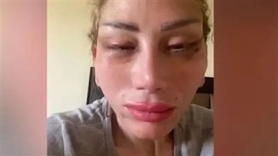 فنانات شهيرات تحت مقصلة عمليات التجميل 