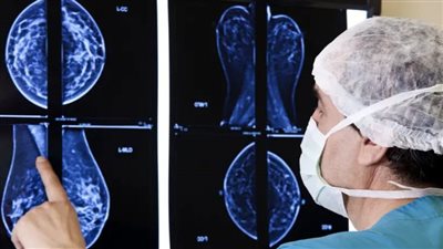 أخطر مما نعتقد.. التثدي لدى الرجال قد يسبب الوفاة المبكرة!