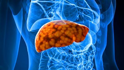 استكمال تدريب العاملين بمنشآت الرعاية الأولية على أعمال مكافحة الفيروسات الكبدية