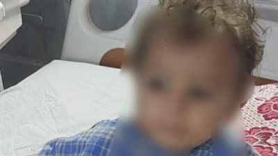 مستشفى الزقازيق تنقذ حياة طفل تعرض لانسداد مجرى التنفس بسبب جسم غريب