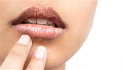 منها زيت جوز الهند.. أفضل  العلاجات المنزلية لجفاف الجلد حول الفم