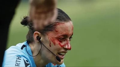 بعد حكمة الدوري الإسباني.. أصعب إصابات الحكام في كرة القدم