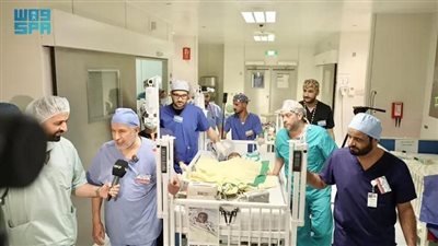 نجاح فصل التوأم السيامي النيجيري 