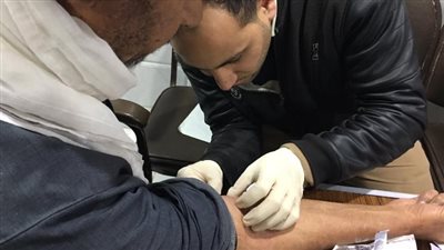 10 عمليات وصلة شريانية وتركيب 4 قساطر مستديمة لمرضى الكلى بمستشفى الزقازيق العام 