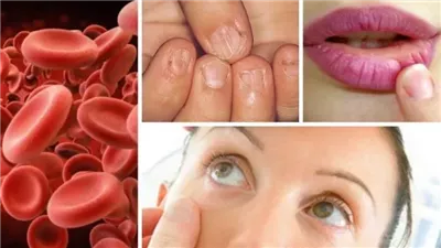 فاكهة تساعد الجسم على امتصاص الحديد بشكل أفضل