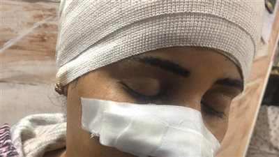 قطع في الأنف ..إصابة ربة منزل بجروح بالغة علي يد جيرانها بسبب دفاعها عن أطفالها أثناء مشاجرة بشبين القناطر 