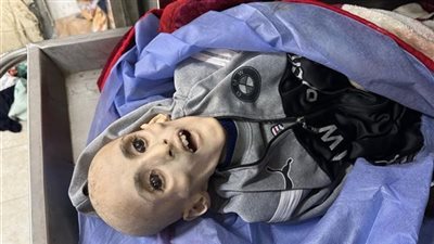حرب التجويع تحصد أرواح الأطفال في غزة.. فيديو