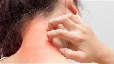 علامات تظهر على الجلد تنذر بأمراض خطيرة