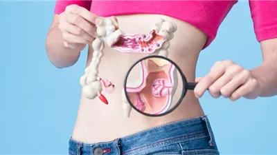  نظام غذائي يزيد من خطر الإصابة بسرطان القولون