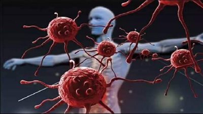 احذر.. أعراض تشير إلى وجود خلل في منظومة المناعة