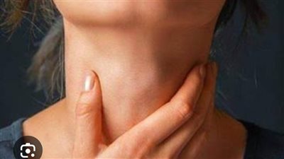 علاقة نقص اليود بالغدة الدرقية